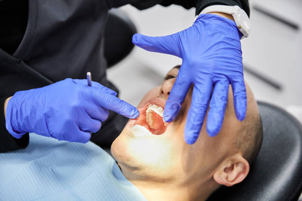 Best Knocked-Out Tooth Emergency  in Dora, AL